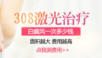 激光308一般多少钱一次 308照白斑效果好不好