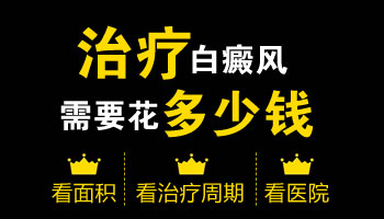 三甲医院光疗白癜风一次收费是多少