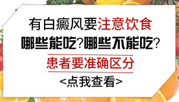 治白癜风不能吃什么 饮食禁忌有哪些