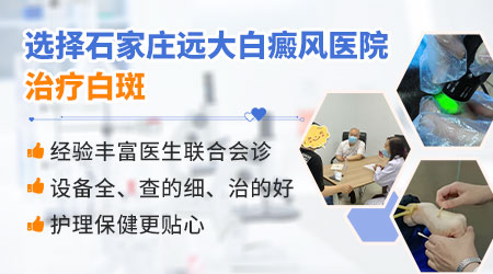 wood灯报告亮白色代表什么