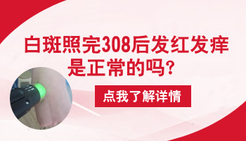 照308后白斑变红发痒是什么原因