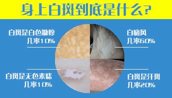 产后的白斑会不会自行消除