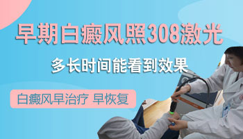 早期白癜风做308激光后会复发吗