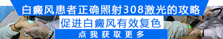 激光照射白癜风时白斑需要涂药吗