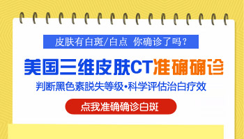 在线咨询：石家庄哪里可以做三维皮肤ct