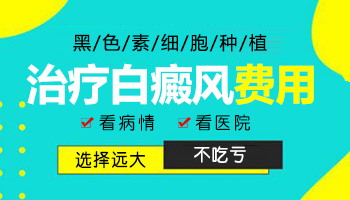 白癜风皮肤移植手术多少钱 【网上预约挂号入口】