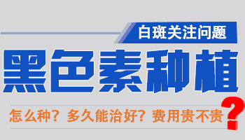 一个月集中治疗可以摆脱白癜风是真的吗