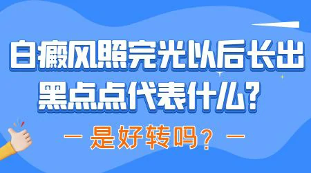 308照白癜风多久有小黑点长出来