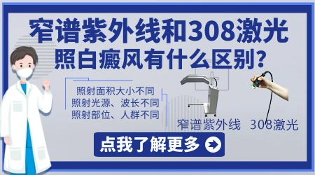 308激光和紫外线灯照白斑的区别