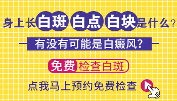 石家庄伍德灯检查白斑一次多少钱