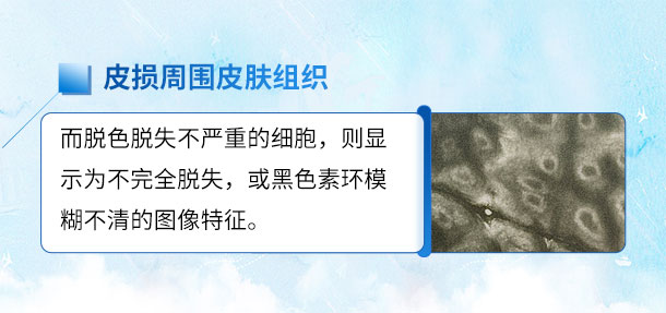 专家来啦!!特邀白癜风专家——苏有明教授将于4月5日来院会诊