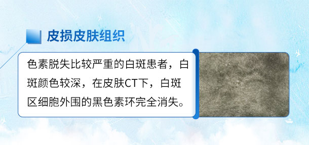 专家来啦!!特邀白癜风专家——苏有明教授将于4月5日来院会诊