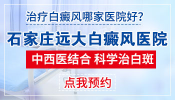 石家庄哪治白癜风好 石家庄专治白斑病