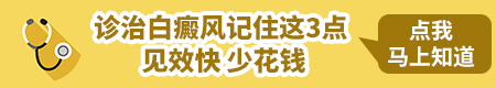 石家庄白斑医院怎么样