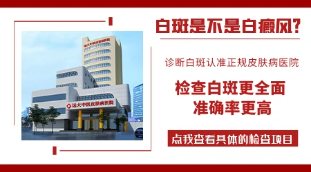 伍德灯下亮白色荧光一定是白癜风吗