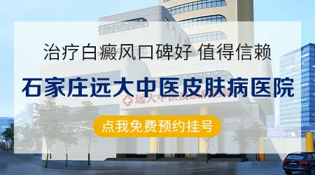 石家庄治白斑好的医院【中医治疗白斑】