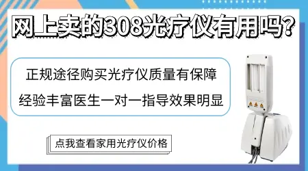 治疗白癜风网上买的仪器好用吗