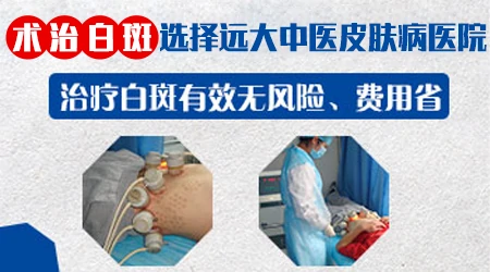 白癜风培植手术刚做完什么样