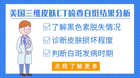 白癜风照射皮肤ct报告单