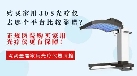 手脚白癜风适合用什么样的家用308仪器