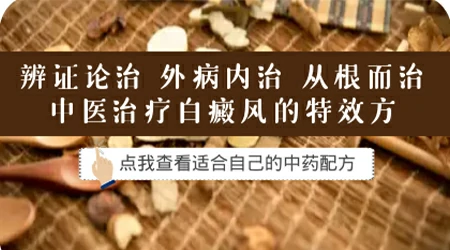 患有白癜风喝中药会好吗