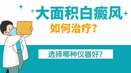 大面积白癜风照308激光怎么治