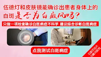 白癜风在皮肤镜底下是什么样的