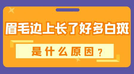 眉毛周边有白块