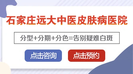 肚脐周围有部分皮肤发白