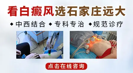 河北治白癜风专科医院哪一家好