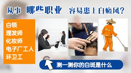 伍德灯下淡白色荧光边界不清是什么
