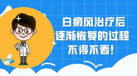 白癜风两年了长大了怎么治