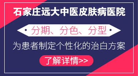 河北皮肤白斑 河北治疗皮肤白斑医院排名