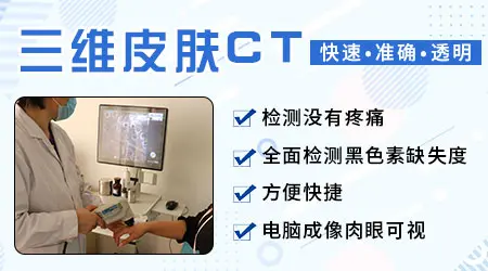 白斑检查伍德灯 [在线问诊]蓝白色白斑是不是白癜风