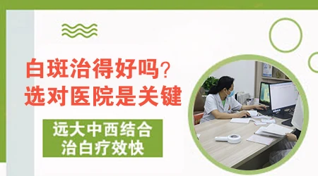 复方卡力孜然酊能不能治好白癜风