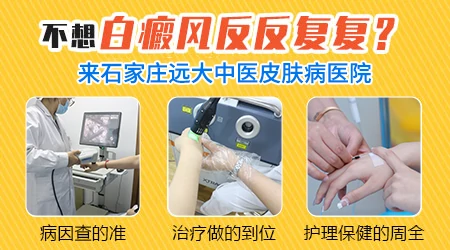 中国治白癜风厉害的医院