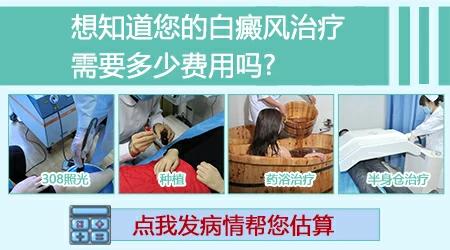 白癜风植皮一次能植多大面积