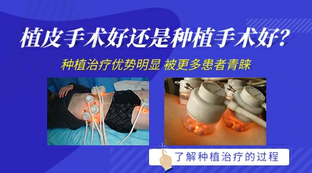 白癜风植皮一次能植多大面积