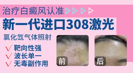 石家庄哪家医院有308激光