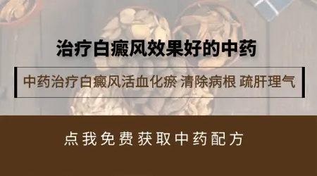 中药治疗白癜风怎么样