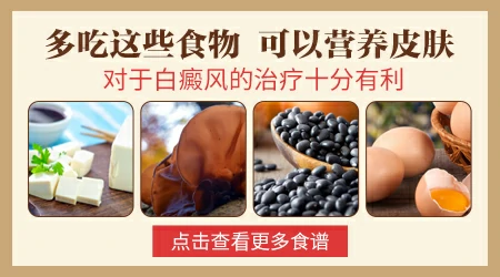 中药治疗白癜风怎么样