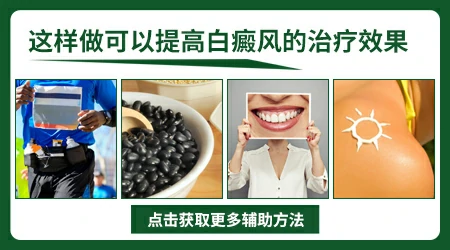 新冠肺炎引发的白癜风能治好吗