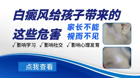 刚满月孩子患白癜风几率大