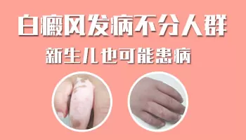 刚满月孩子患白癜风几率大