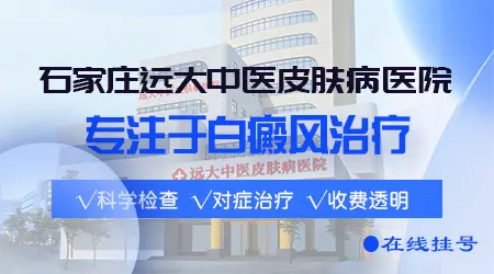 311窄谱uvb照可以治好白癜风吗