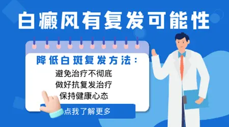 顽固的白癜风怎么治 白癜风为什么总是反复
