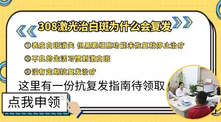 308治好面部白斑以后会复发吗