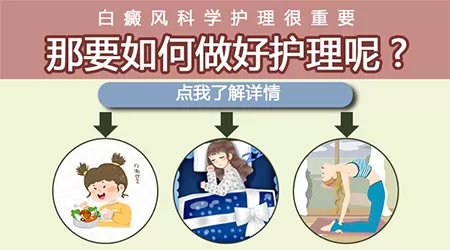 进口激光治疗白癜风费用高不高