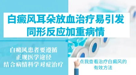 白癜风耳朵放血治疗有用吗
