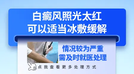 照了uvb以后白斑变红了正常吗